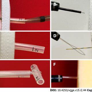 Description of techniques. A: The "push" Technique: A Savary dilator... | Download Scientific ...