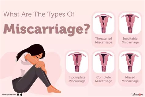 Miscarriage: Signs, Symptoms, Treatment And Prevention