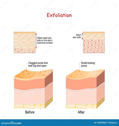 Cross-section of Skin Layers before and after Exfoliation Stock Vector - Illustration of ...