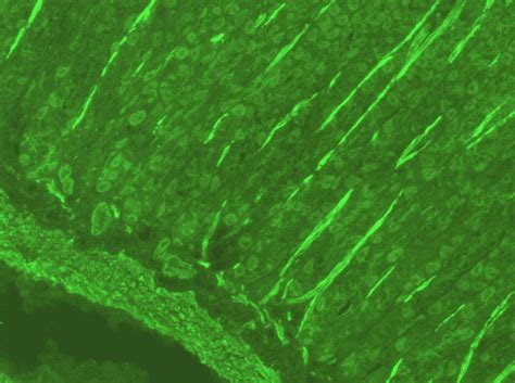 Anti-smooth muscle antibodies (ASMA) positive control - Launch Diagnostics