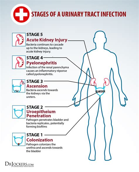 5 Phases to Support Urinary Health Naturally - DrJockers.com | Uti remedies, Bladder infection ...