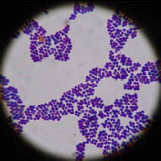 S. aureus showing resistant to cefoxitin (centre disc) and other ...