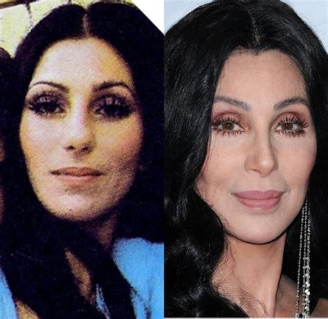 When people say Cher is unrecognizable from "all" the plastic surgery ...