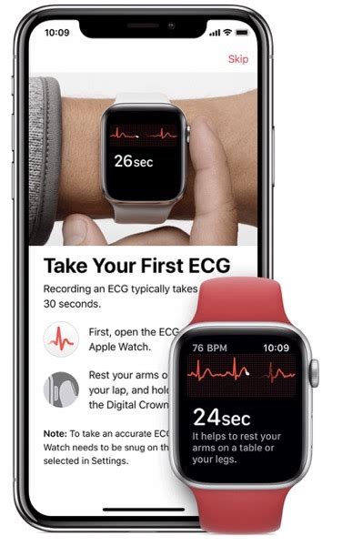 How to Install and Use the ECG App on Apple Watch Series 4 in Canada ...