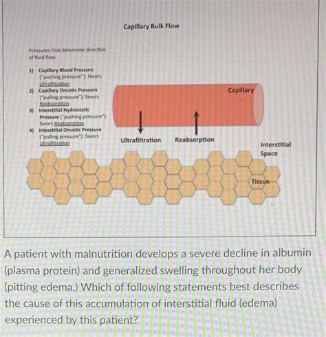 Answered: Low albumin causes an increase in… | bartleby