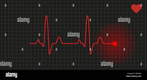 Free Clipart Heart Monitor Graph