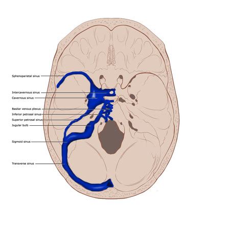 Dural venous sinuses | Radiology Reference Article | Radiopaedia.org