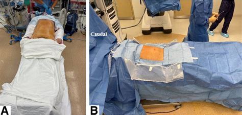 A) The patient is positioned supine, bony prominences well padded, arms ...