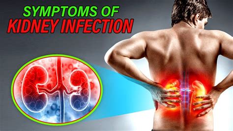 Symptoms of Kidney Infection - YouTube