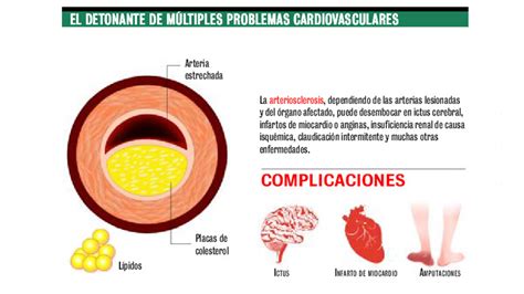 La presencia de ateroma en cualquier arteria demuestra que ya hay daño ...