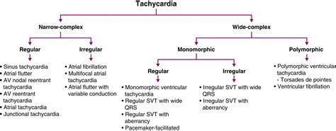 Algorithm For Differential Diagnosis Of Ventricular Tachycardia And Images