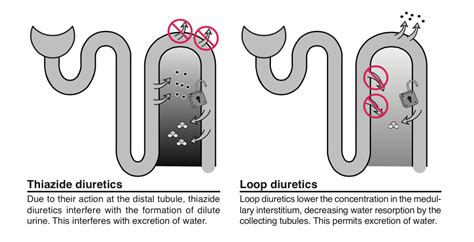 SIADH and lasix – Precious Bodily Fluids