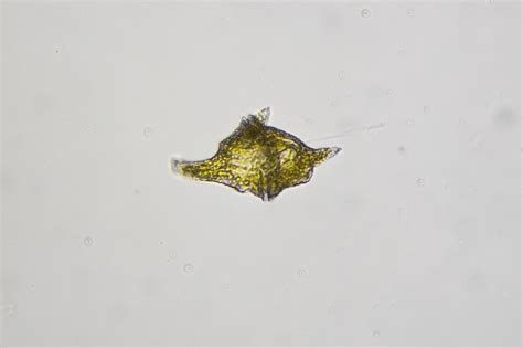 Peridinium | The Microscopic Life of Shetland Lochs