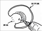 痔の手術で肛門が開発済みになる  ヤフオクで不動バイクを買ってはい�ない！ sketch template