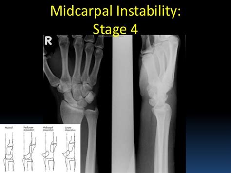 Radiographic MSK Anatomy