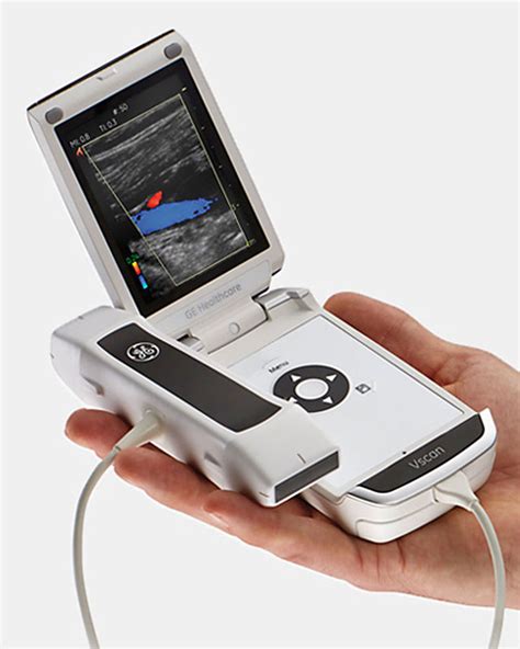 GE VSCAN with Dual Probe Ultrasound Machine | KPI Healthcare