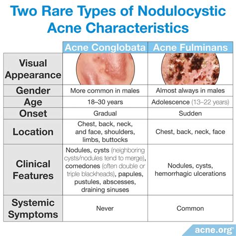 Cystic Acne on the Body - Acne.org