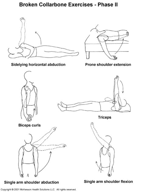 Sports Medicine Advisor 2003.1: Broken Collarbone Exercises, Phase II: Illustration