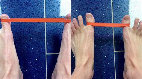 Bunion or Hallux Valgus Exercises - YouTube