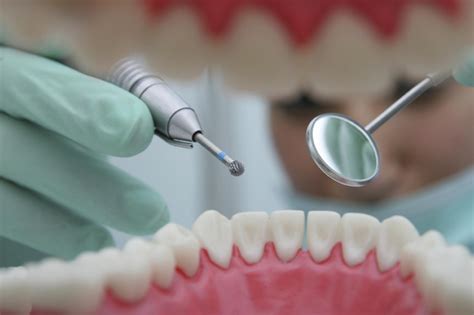 Australian study finds 'no-drill' dentistry s | EurekAlert!