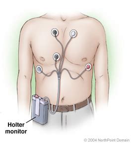 24HR HOLTER MONITORING | Melbourne Cardiovascular & Diabetes Centre