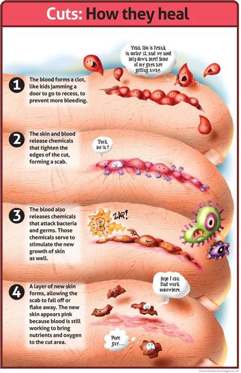 How a Cut Heals Classroom Poster .pdf File - Etsy | Medical careers ...