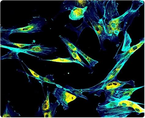 What is the Actin Cytoskeleton?