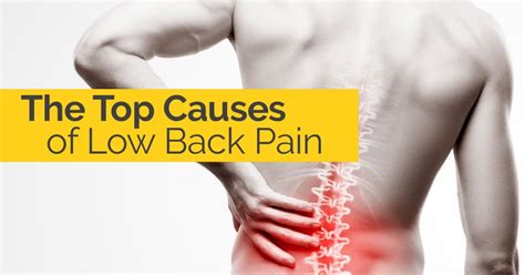 Low Back Pain Pictures: Symptoms, Causes, Treatments