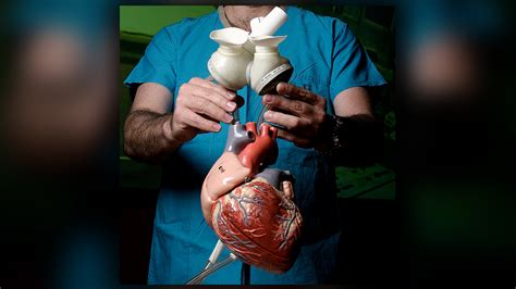 1,000th heart transplant performed at Houston Methodist Hospital