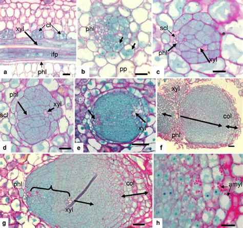 Rhizogenesis in date palm leaf (d5-d28). Three micrometersemi-thin... | Download Scientific Diagram