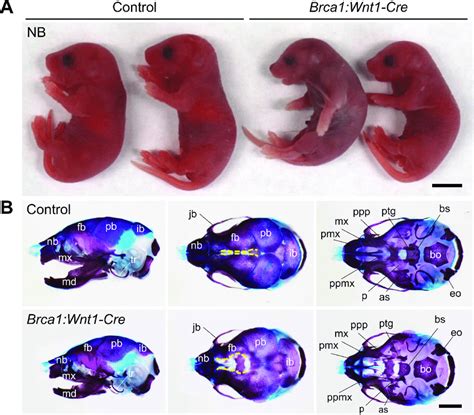 Neural crest cell-specific Brca1 deletion causes craniofacial bone ...