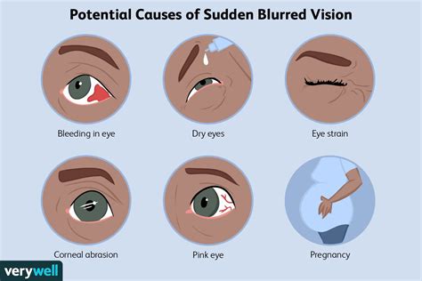 What Can Cause Blurred Vision All of a Sudden? - Infrared for Health