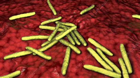 Leprosy bacteria, illustration - Stock Image - F027/7602 - Science ...