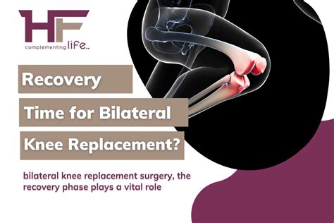 Recovery Time For Bilateral Knee Replacement - HealthFinder