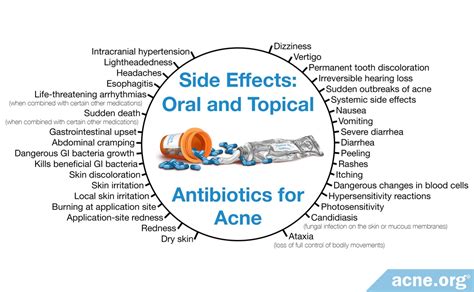 Are Antibiotics a Good Idea for the Treatment of Acne? - Acne.org