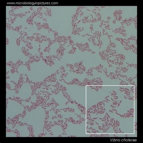 Vibrio cholerae. Gram stain and cell morphology. Vibrio cholerae micrograph, appearance under ...