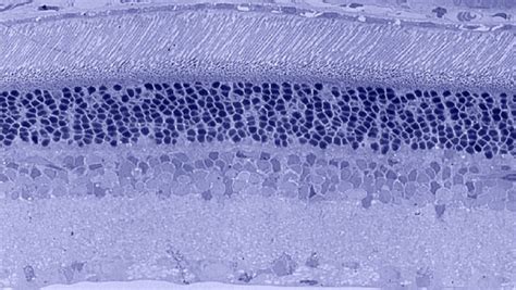 Figure 5. [Toluidine blue stain of wild...]. - Webvision - NCBI Bookshelf