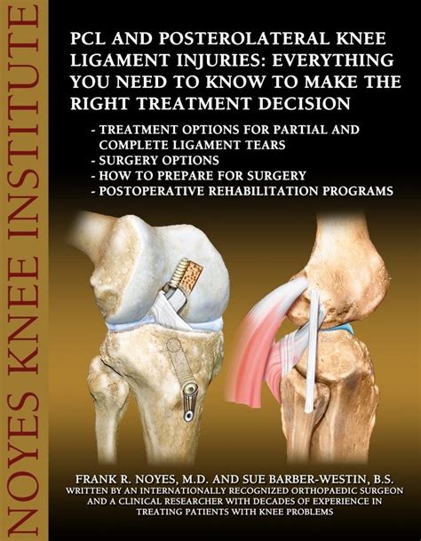 PCL Reconstruction - The Noyes Knee Institute