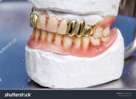 483 Gold Denture Stock Photos, Images & Photography | Shutterstock