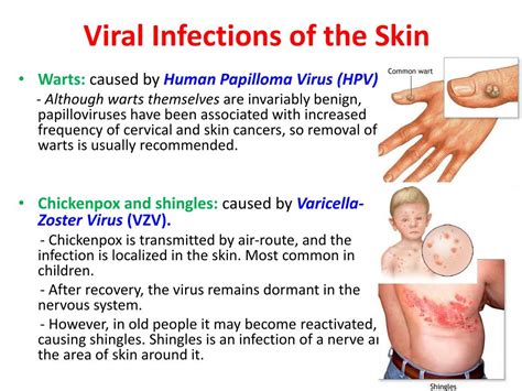 PPT - Infectious Diseases of the Skin PowerPoint Presentation, free ...