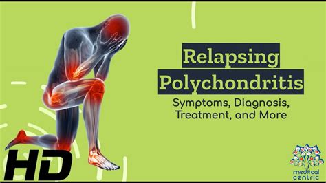 Relapsing Polychondritis Demystified: From Symptoms to Solutions - YouTube