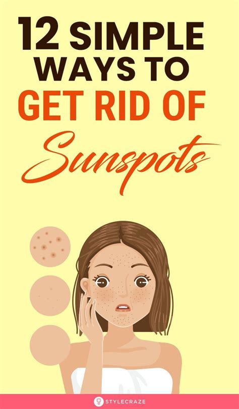 10 best home remedies for sunspots causes and treatments – Artofit