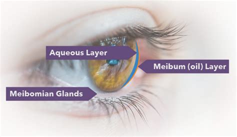 dry-eye-sibia | Sibia Eye Institute