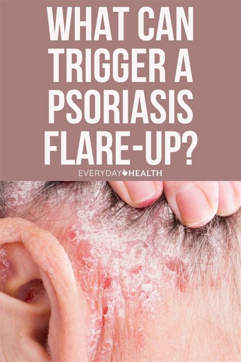 What is psoriasis symptoms causes diagnosis treatment and prevention – Artofit