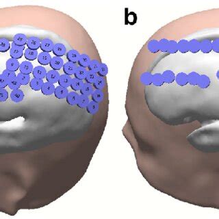 a ECoG with 56 electrodes grid; b 29 electrodes used for signal processing | Download Scientific ...