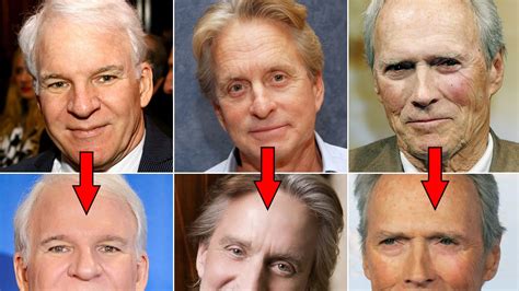 Steve Martin, Simon Cowell, & More Male Celebs Who May Have Had Plastic Surgery (photos)