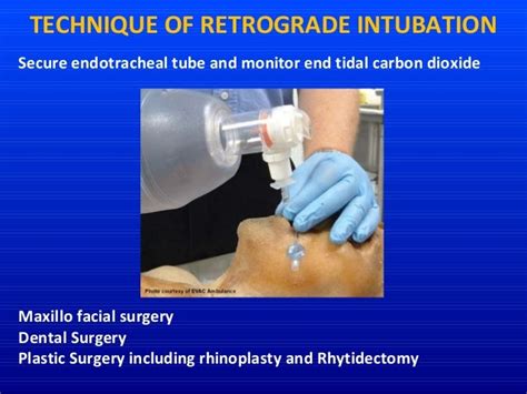 Alternative technique of intubation retromolar, retrograde, submental…