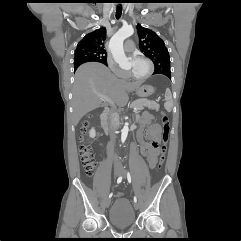 Whole Body CT - Insight Medical Imaging