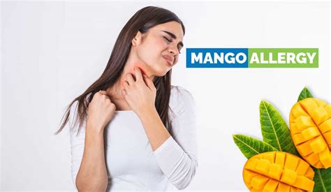 Mango Allergy - Symptoms, Causes, Prevention, Treatments, More