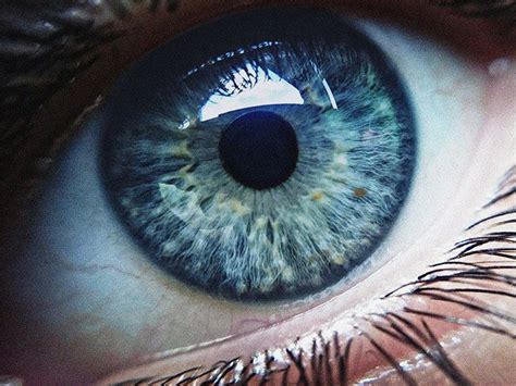 Psoriatic arthritis and eye problems: When to seek help